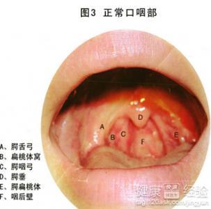 慢性咽炎最新研究及治疗进展概览