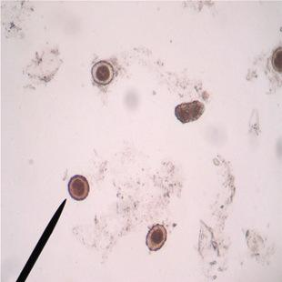 蛔虫虫卵最新研究进展解读