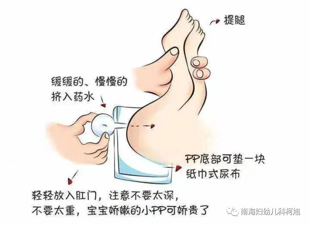 儿子不当使用开塞露导致父亲动脉血管破裂