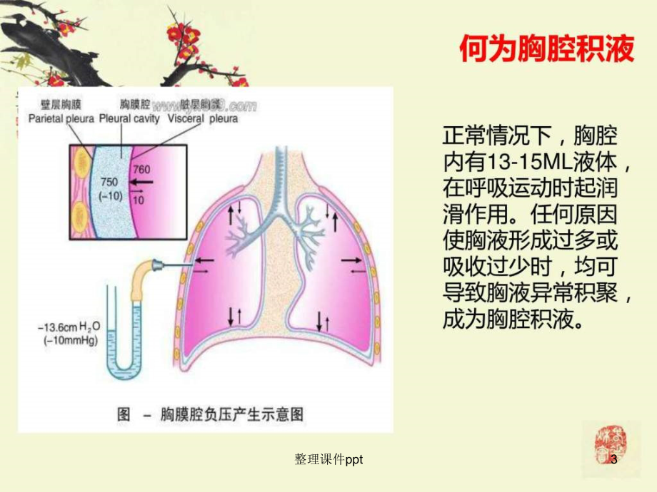 胸腔积液PPT模板，胸腔积液形成与治疗策略