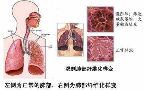 疫情当前，最新动态与应对策略